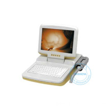 Infrared Inspection Equipment for Mammary Gland (Portable type)